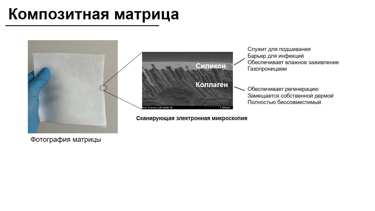 Матрица «ВЕЛИСТРА» - композитная коллагеновая матрица
