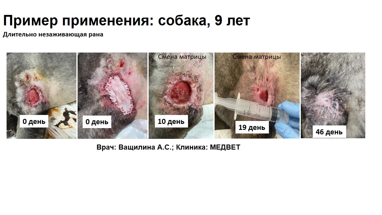 Технология регенерации кожи с использованием коллагеновой матрицы